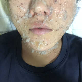 23years old 아쿠아밥 모델링 마스크 — 3.33점을 준 리뷰어가 2018년 4월 올린 사용 사진