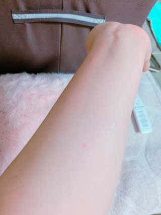 뷰티여우_아토클리닉 [아토클리닉] 아기들이 쓰는 보습, 진정 수딩젤 2개 — 4.5점을 준 리뷰어가 2019년 7월 올린 사용 사진