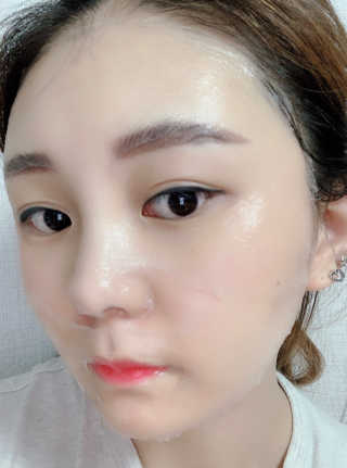 메디타임 멜라반 더마 토닝 씬젤 — 2.5점을 준 리뷰어가 2019년 4월 올린 사용 사진
