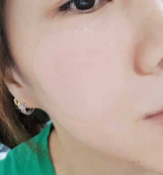 자이엘 S.O.S 레드 칙 케어팩 2 Box — 5점을 준 리뷰어가 2020년 2월 올린 사용 사진