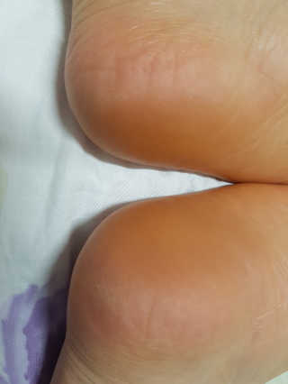 (주)에네스티 에네스티 수안수 실크스킨 풋크림 1+1 — 5점을 준 리뷰어가 2019년 9월 올린 사용 사진