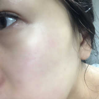 비알티씨 더 퍼스트 앰플 에센스 — 3.5점을 준 리뷰어가 2019년 4월 올린 사용 사진