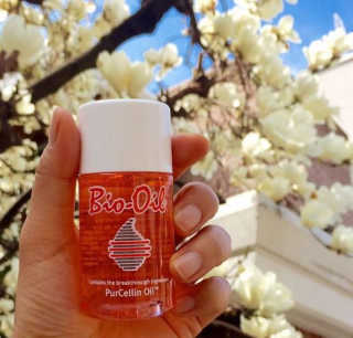 Bio-oil(바이오오일) 바이오오일(Bio-oil) — 5점을 준 리뷰어가 2017년 2월 올린 사용 사진