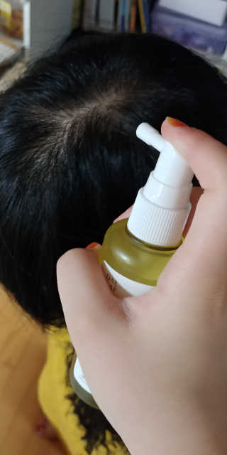 달리프 클로렐라 베러 루트 헤어토닉 100ml — 5점을 준 리뷰어가 2019년 8월 올린 사용 사진
