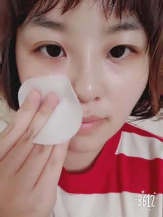 미플레이 진짜 티트리 토너 패드 — 5점을 준 리뷰어가 2018년 11월 올린 사용 사진