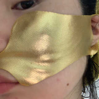 [스케덤] 상악밴드 — 5점을 준 리뷰어가 2019년 7월 올린 사용 사진