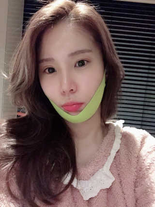 스케덤 시카 리프팅밴드 — 4점을 준 리뷰어가 2019년 4월 올린 사용 사진