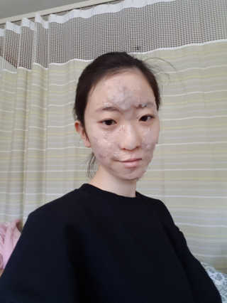 23years old 아쿠아밥 모델링 마스크 — 4점을 준 리뷰어가 2018년 2월 올린 사용 사진