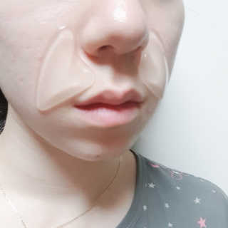 아이디플라코스메틱 아이디 페이스핏 플러스 패치 — 4점을 준 리뷰어가 2019년 10월 올린 사용 사진