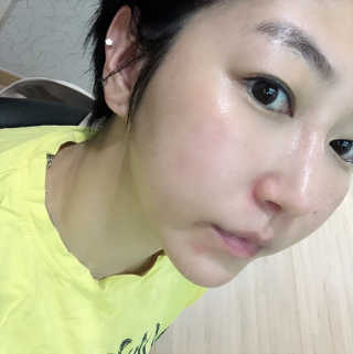 [메디페르] 루테인크림 — 4점을 준 리뷰어가 2019년 9월 올린 사용 사진