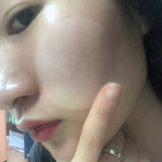 자이엘 S.O.S 레드 칙 케어팩 2 Box — 5점을 준 리뷰어가 2020년 1월 올린 사용 사진