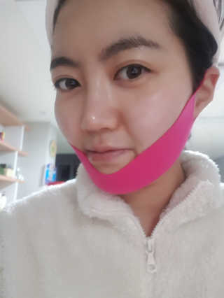 스케덤 펩타이드 리프팅밴드 — 4점을 준 리뷰어가 2019년 2월 올린 사용 사진