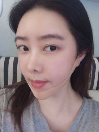 아이디플라코스메틱 아이디 페이스핏 마이너스 밴드 — 5점을 준 리뷰어가 2019년 10월 올린 사용 사진