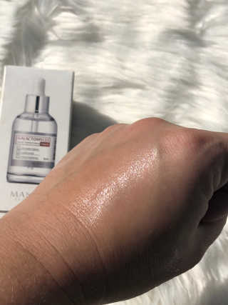 [마녀 공장] 발가락 토미 니아신 에센스 50ml — 4.5점을 준 리뷰어가 2018년 11월 올린 사용 사진