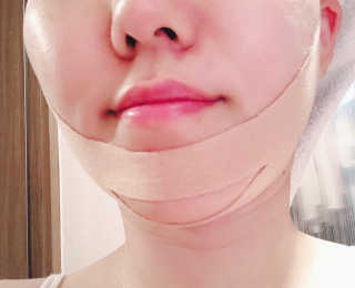 아이디플라코스메틱 아이디 페이스핏 마이너스 밴드 — 5점을 준 리뷰어가 2019년 9월 올린 사용 사진