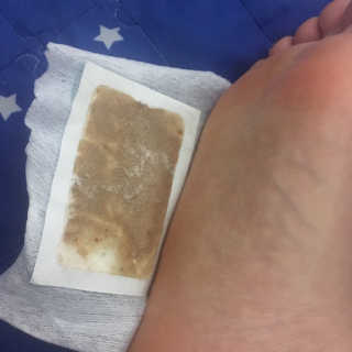 메디테라피 더마 릴렉스 힐링패치 — 4.5점을 준 리뷰어가 2018년 4월 올린 사용 사진
