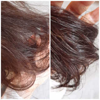 (주)에네스티 믹스베리 폭탄 트리트먼트 1000g — 5점을 준 리뷰어가 2019년 12월 올린 사용 사진