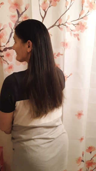 아이로로 디어 스칼프 인핸 시브 안티 헤어 로스 트리트먼트 — 4.5점을 준 리뷰어가 2020년 2월 올린 사용 사진