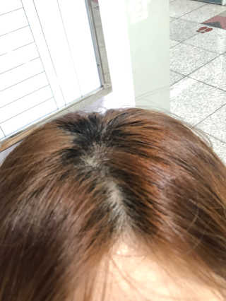 달리프 클로렐라 베러 루트 쿨링 스프레이 100ml — 5점을 준 리뷰어가 2019년 7월 올린 사용 사진
