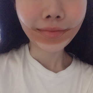 아이디플라코스메틱 아이디 페이스핏 마이너스 밴드 — 4점을 준 리뷰어가 2020년 1월 올린 사용 사진