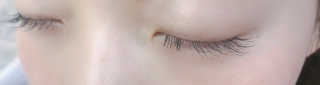Viewty Skin and Lash [ViewtySkin＆Lash] 종아리 림프순환 부종관리 — 4.5점을 준 리뷰어가 2019년 2월 올린 사용 사진