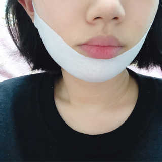 스케덤 클루덤 리프팅 패치 — 3.5점을 준 리뷰어가 2019년 3월 올린 사용 사진