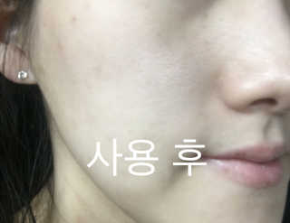 뷰디아니 지친 내 피부를 위한 첫 수분 모이스트 01 토너 — 4.67점을 준 리뷰어가 2018년 5월 올린 사용 사진