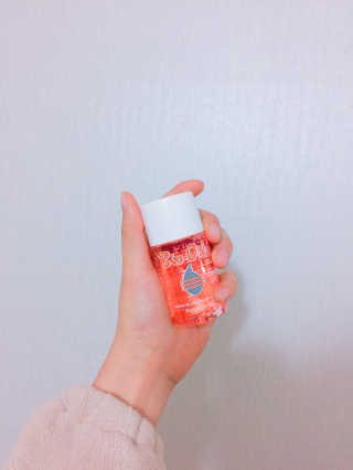 Bio-oil(바이오오일) 바이오오일(Bio-oil) — 5점을 준 리뷰어가 2017년 2월 올린 사용 사진