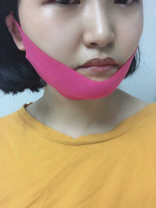 스케덤 펩타이드 리프팅밴드 — 3점을 준 리뷰어가 2019년 3월 올린 사용 사진