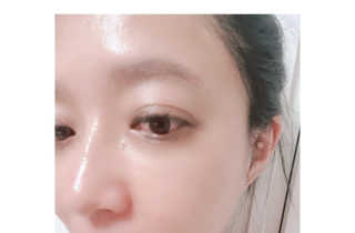 메디페르루테인앰플 3종 — 5점을 준 리뷰어가 2019년 9월 올린 사용 사진