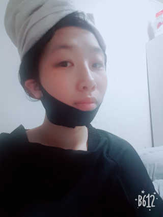 어웨이크어슬립 어슬립 페이스 리프트업 밴드 — 3.83점을 준 리뷰어가 2018년 5월 올린 사용 사진