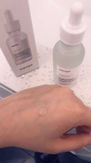 [마녀 공장] 발가락 토미 니아신 에센스 50ml — 5점을 준 리뷰어가 2019년 6월 올린 사용 사진