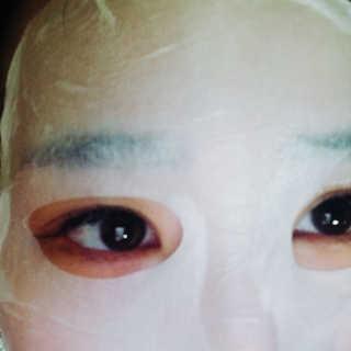 23years old 바데카실 더마실 마스크 — 5점을 준 리뷰어가 2018년 4월 올린 사용 사진