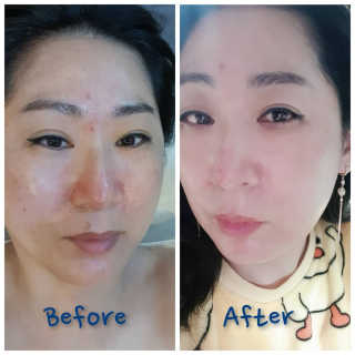 ♥️여봉달달달♥️님이 올린 리뷰 사진 1