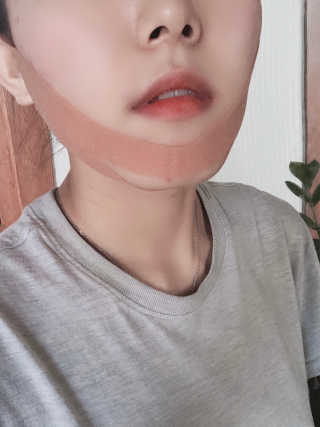 아이디플라코스메틱 아이디 페이스핏 마이너스 밴드 — 3점을 준 리뷰어가 2020년 4월 올린 사용 사진