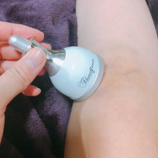 [더마퀸]쿨링스틱 페이스앤아이 — 4점을 준 리뷰어가 2019년 6월 올린 사용 사진