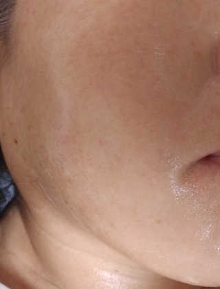 카미안느 프랑스콜라겐크림 — 5점을 준 리뷰어가 2018년 3월 올린 사용 사진