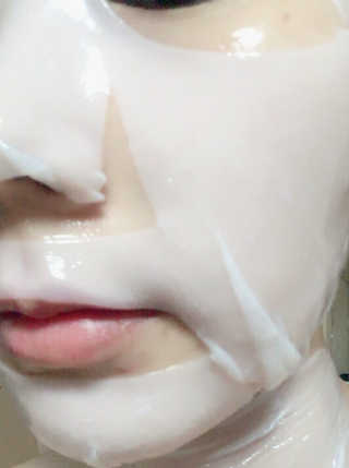 아쿠아큐링 아쿠아덤 바이오셀룰로오스 페이스앤넥 마스크팩 10매 — 4.83점을 준 리뷰어가 2018년 9월 올린 사용 사진