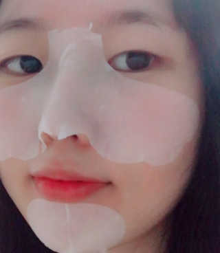 나이팅게일 3STEP 타코팩(문어팩) — 4점을 준 리뷰어가 2017년 8월 올린 사용 사진