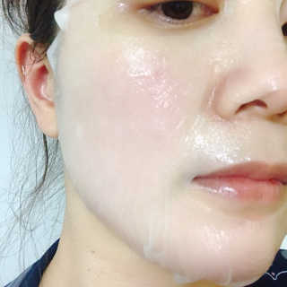 로벡틴 닥터 마스크 아쿠아 — 3점을 준 리뷰어가 2019년 12월 올린 사용 사진