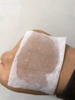 메디필 에스테 더마 레드마린 콜라겐 토너 — 5점을 준 리뷰어가 2020년 1월 올린 사용 사진