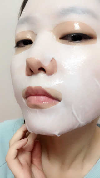 메가더마톨로지 메가닥터브라이트닝 W10 10매 — 5점을 준 리뷰어가 2017년 12월 올린 사용 사진