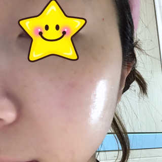 아이소이 잡티세럼 대용량 i♡i 아이러브아이 리미티드 에디션 — 4.67점을 준 리뷰어가 2018년 5월 올린 사용 사진