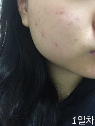 23years old 바데카실P — 3.5점을 준 리뷰어가 2017년 1월 올린 사용 사진