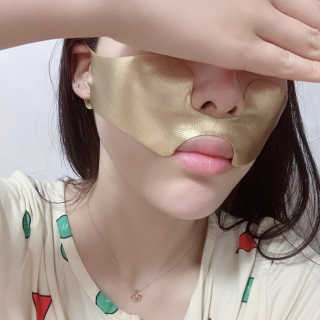 [스케덤] 상악밴드 — 3점을 준 리뷰어가 2019년 6월 올린 사용 사진