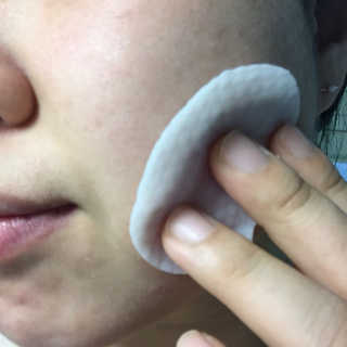 나이팅게일 토닝 필링패드(티트리) — 5점을 준 리뷰어가 2018년 2월 올린 사용 사진
