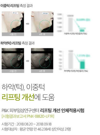스케덤 시카 리프팅밴드 — 5점을 준 리뷰어가 2019년 6월 올린 사용 사진