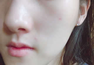2018 아이소이 잡티세럼 리미티드 컬렉션 — 5점을 준 리뷰어가 2018년 9월 올린 사용 사진