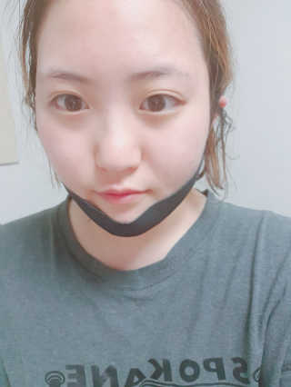 어웨이크어슬립 어슬립 페이스 리프트업 밴드 — 3.17점을 준 리뷰어가 2018년 7월 올린 사용 사진