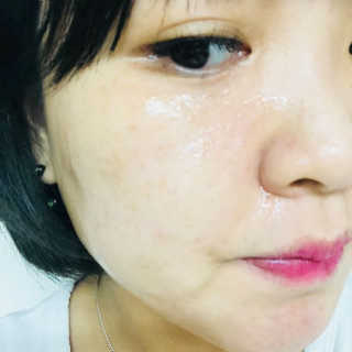 셀레뷰 슈퍼 모이스처 수딩젤 — 4점을 준 리뷰어가 2018년 3월 올린 사용 사진